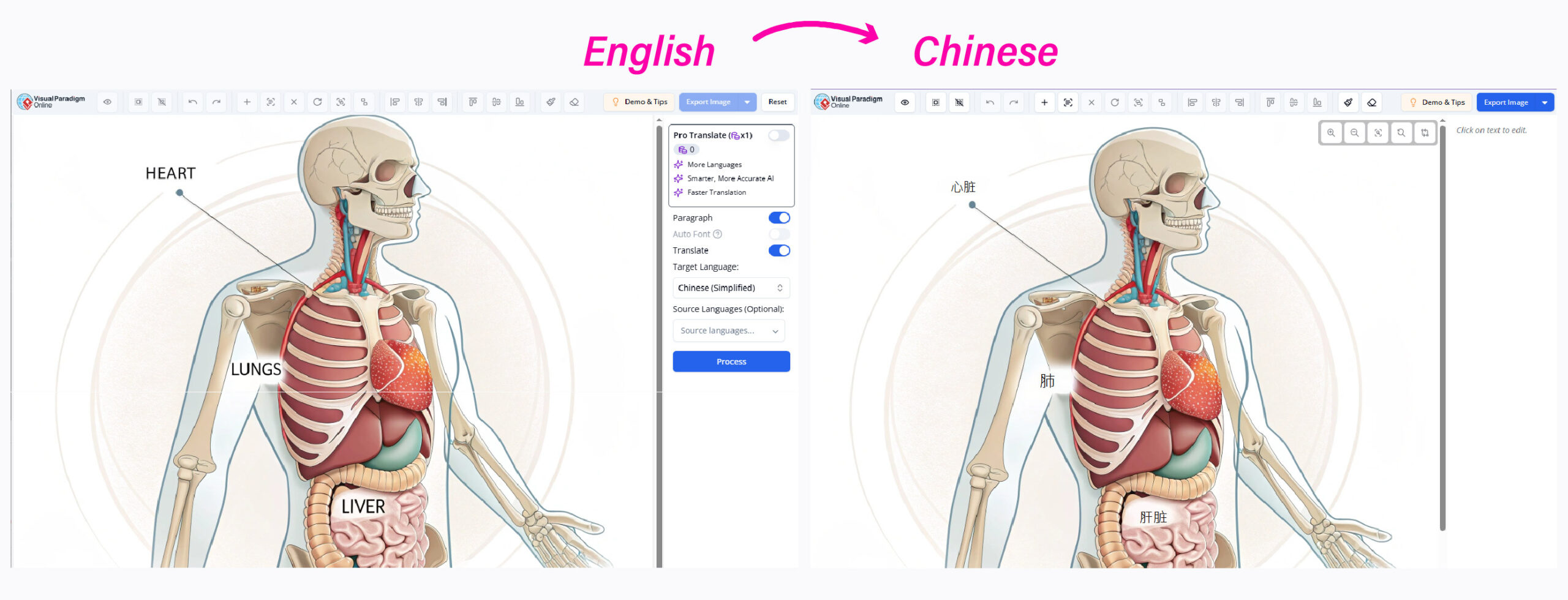 Before/after of a translated anatomy diagram. Alt text: "AI Image Translator accurately converts medical annotations from English to Chinese.